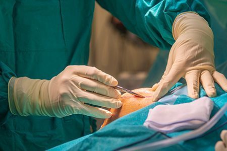 Image hover effect image